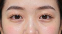 facial signs of hydration