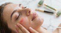 managing acne effectively naturally
