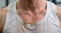 skin irritation from workout wear